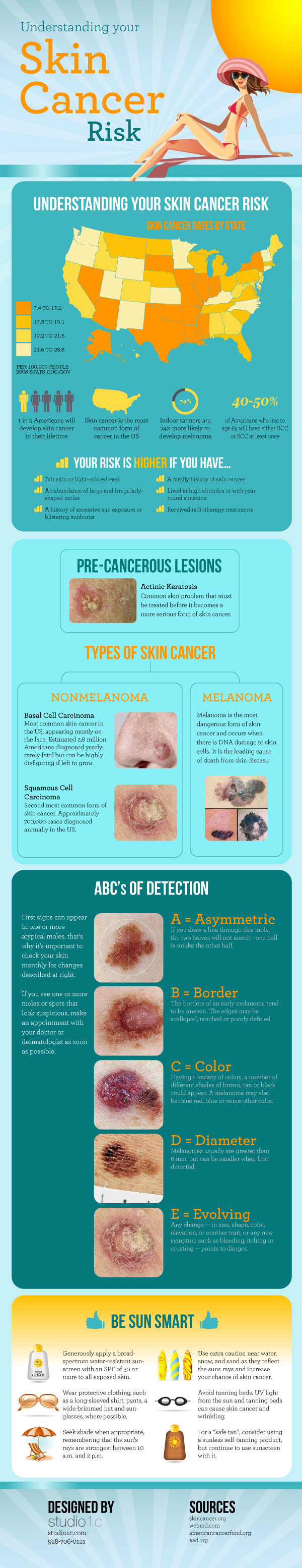 skin cancer detection infographic